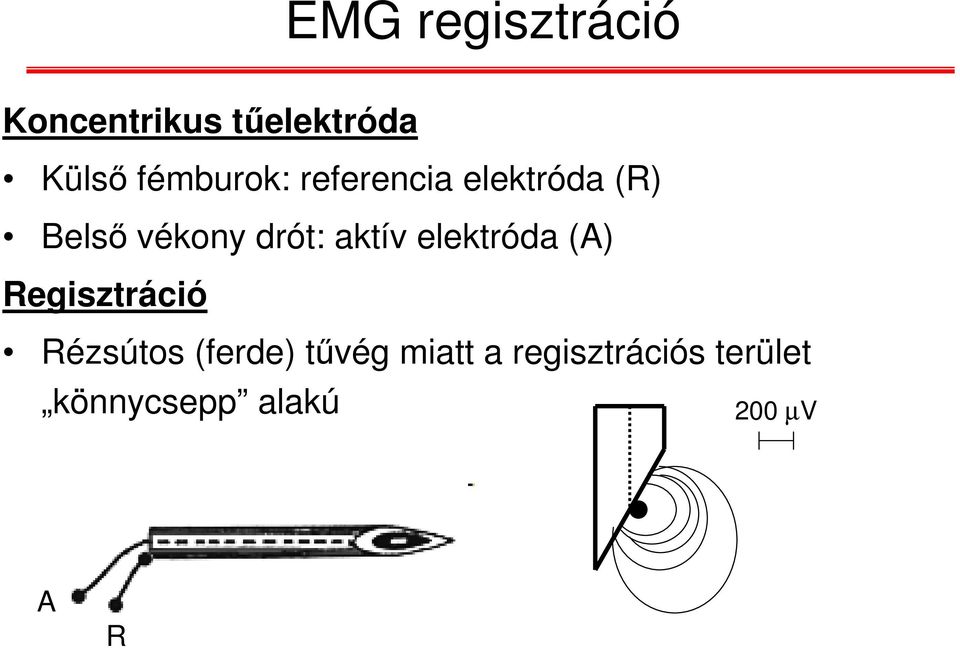 aktív elektróda (A) Regisztráció Rézsútos (ferde)