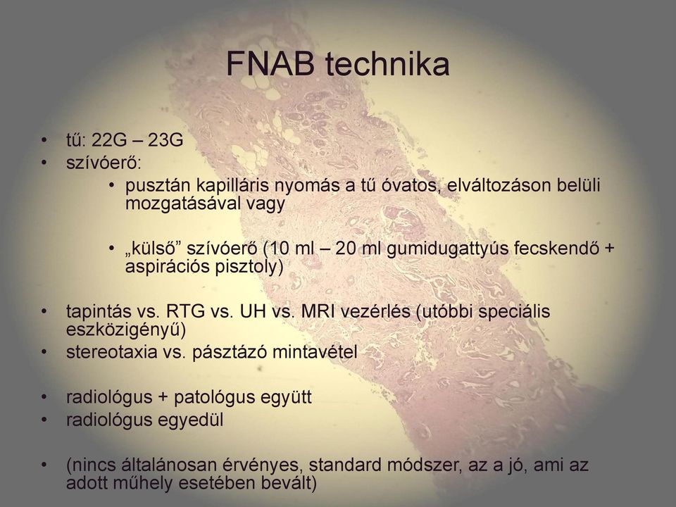 MRI vezérlés (utóbbi speciális eszközigényű) stereotaxia vs.