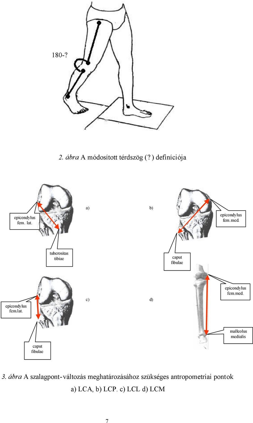 c) d) epicondylus fem.med. malleolus medialis caput fibulae 3.