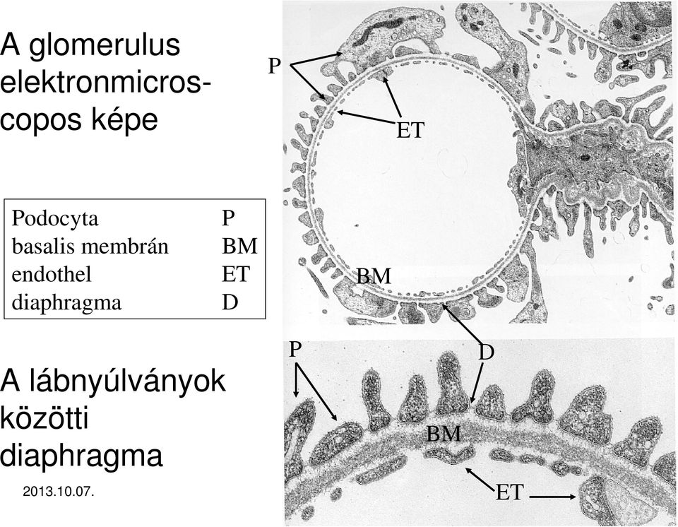 diaphragma P BM ET D BM A lábnyúlványok