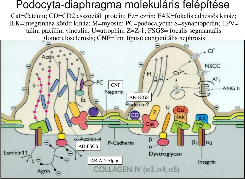 S=synaptopodin; TPV= talin, paxillin, vinculin; U=utrophin; Z=Z-1; FSGS= focalis segmantalis