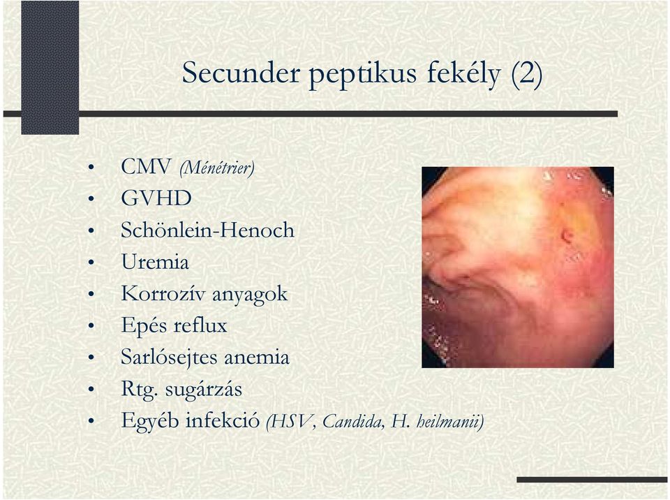 anyagok Epés reflux Sarlósejtes anemia Rtg.