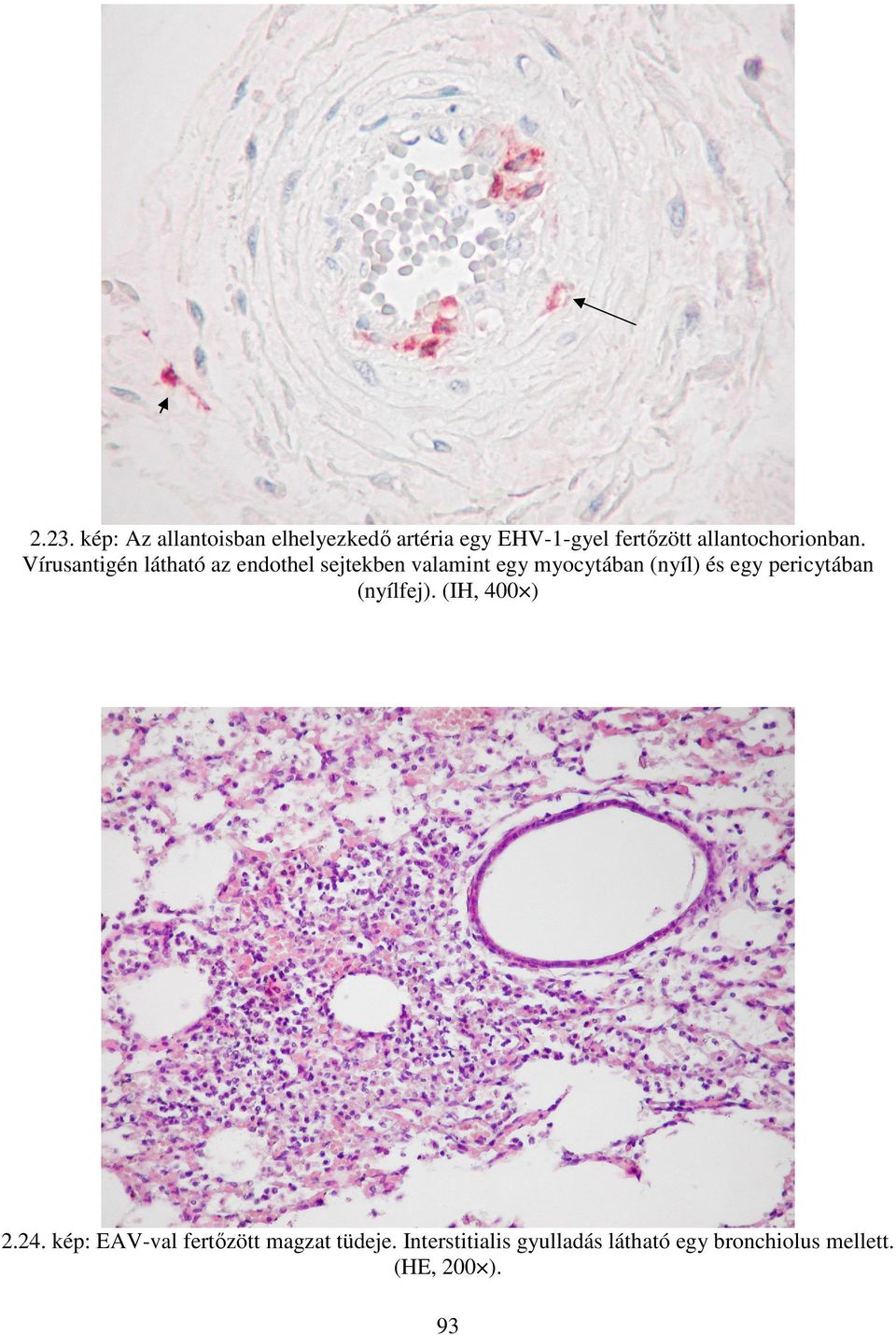 Vírusantigén látható az endothel sejtekben valamint egy myocytában (nyíl) és egy