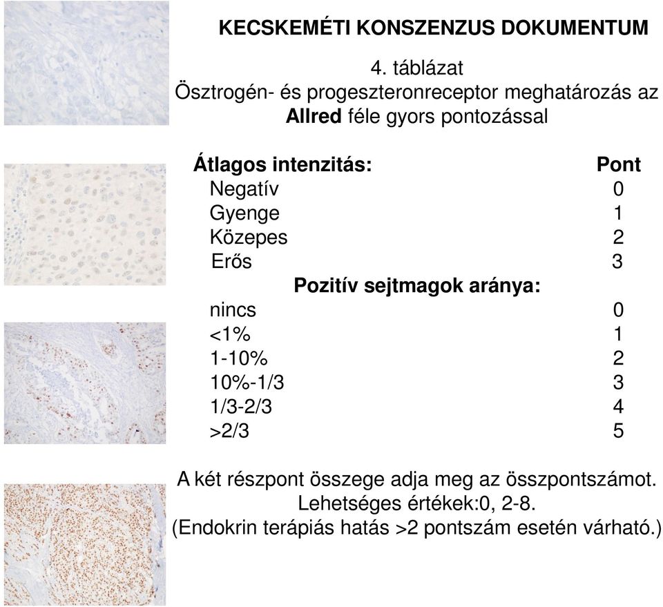 intenzitás: Pont Negatív 0 Gyenge 1 Közepes 2 Erős 3 Pozitív sejtmagok aránya: nincs 0 <1 1 1-10