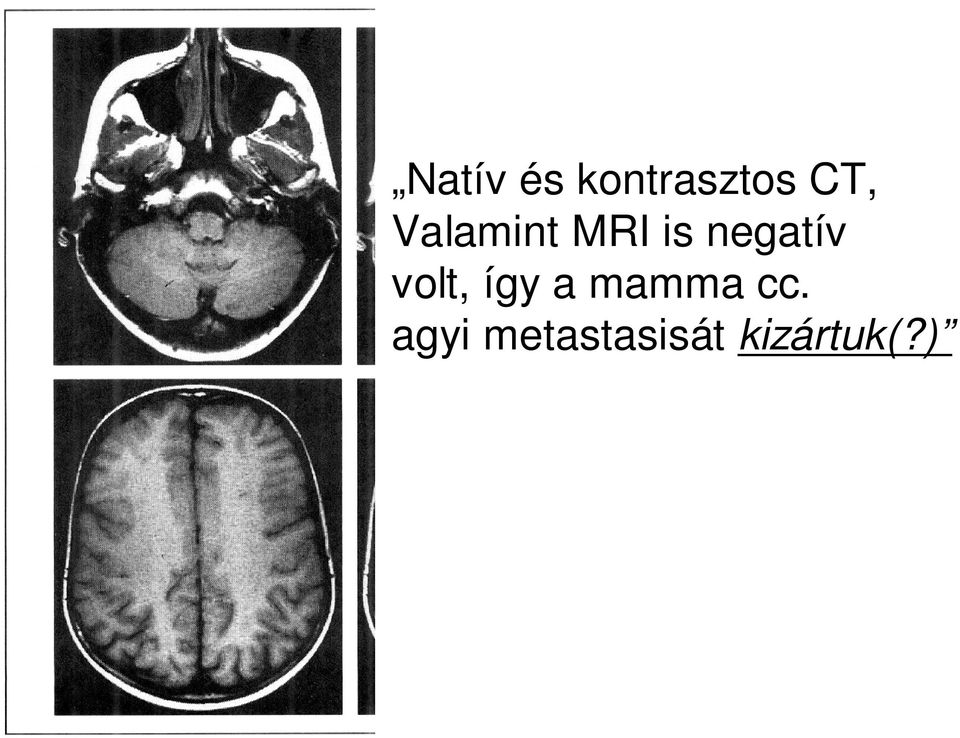 volt, így a mamma cc.
