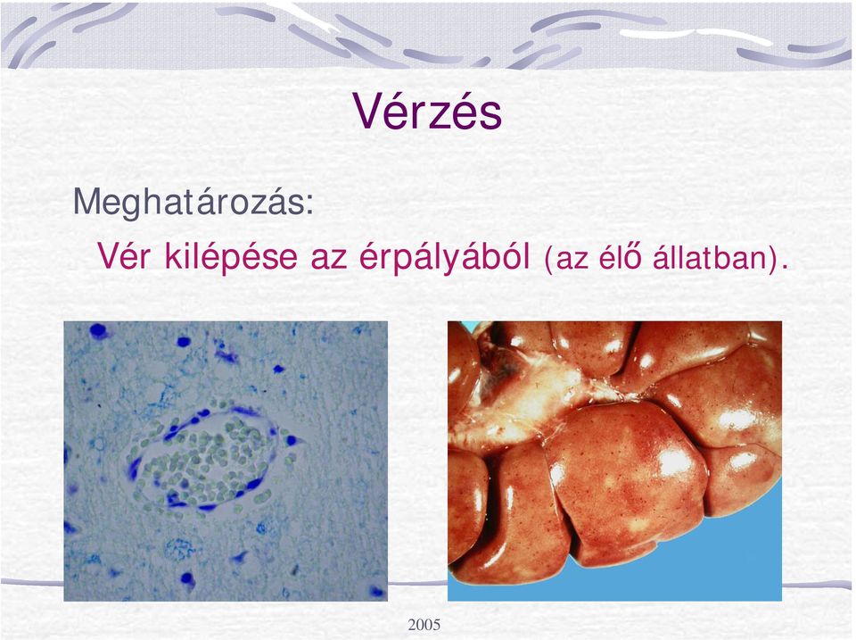 Vér kilépése az