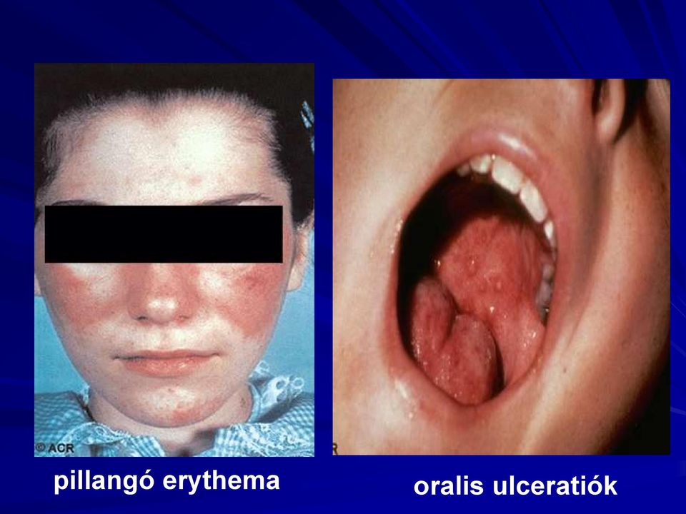 oralis