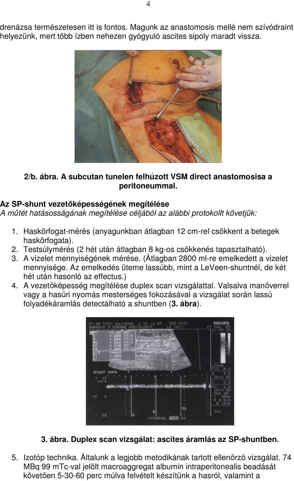 Haskörfogat-mérés (anyagunkban átlagban 12 cm-rel csökkent a betegek haskörfogata). 2. Testsúlymérés (2 hét után átlagban 8 kg-os csökkenés tapasztalható). 3. A vizelet mennyiségének mérése.