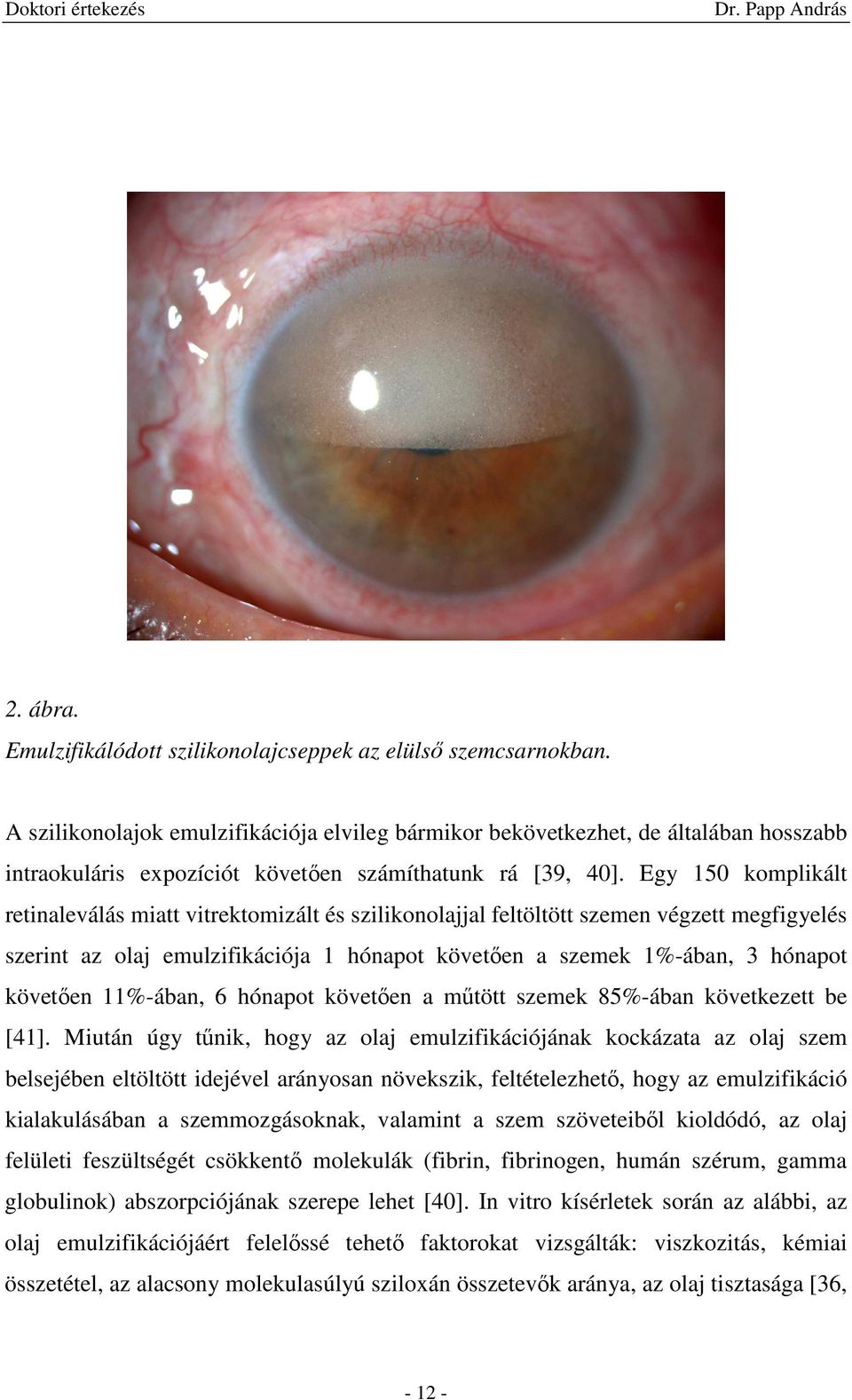 Egy 150 komplikált retinaleválás miatt vitrektomizált és szilikonolajjal feltöltött szemen végzett megfigyelés szerint az olaj emulzifikációja 1 hónapot követıen a szemek 1%-ában, 3 hónapot követıen