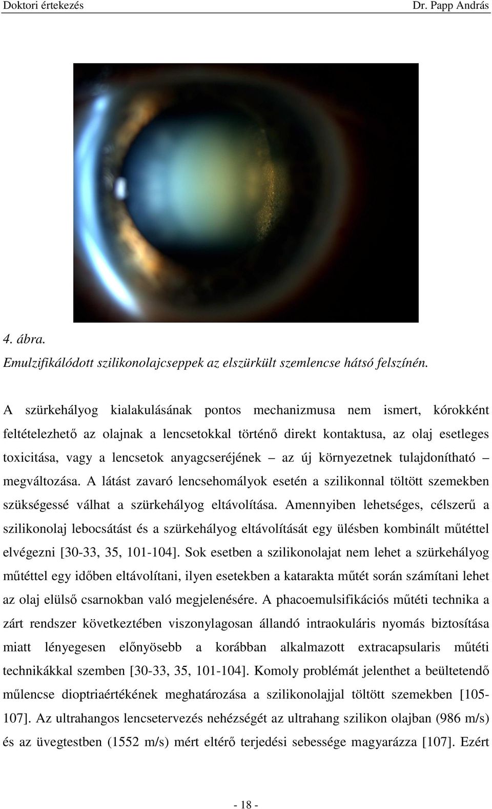 anyagcseréjének az új környezetnek tulajdonítható megváltozása. A látást zavaró lencsehomályok esetén a szilikonnal töltött szemekben szükségessé válhat a szürkehályog eltávolítása.