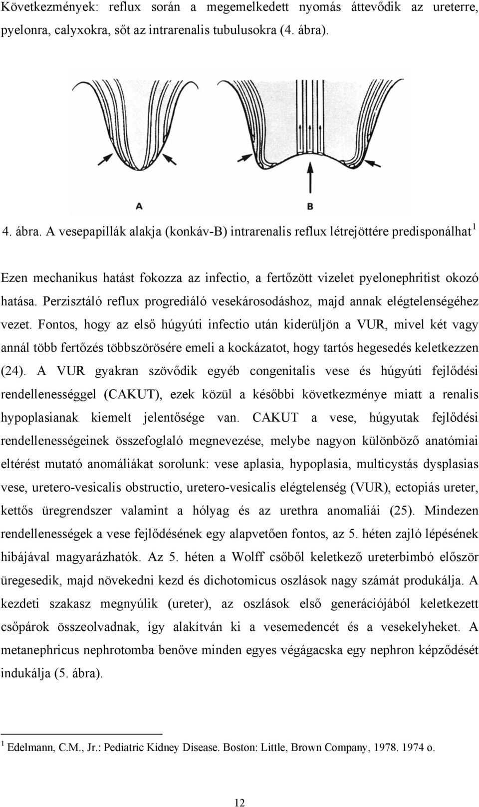 Perzisztáló reflux progrediáló vesekárosodáshoz, majd annak elégtelenségéhez vezet.