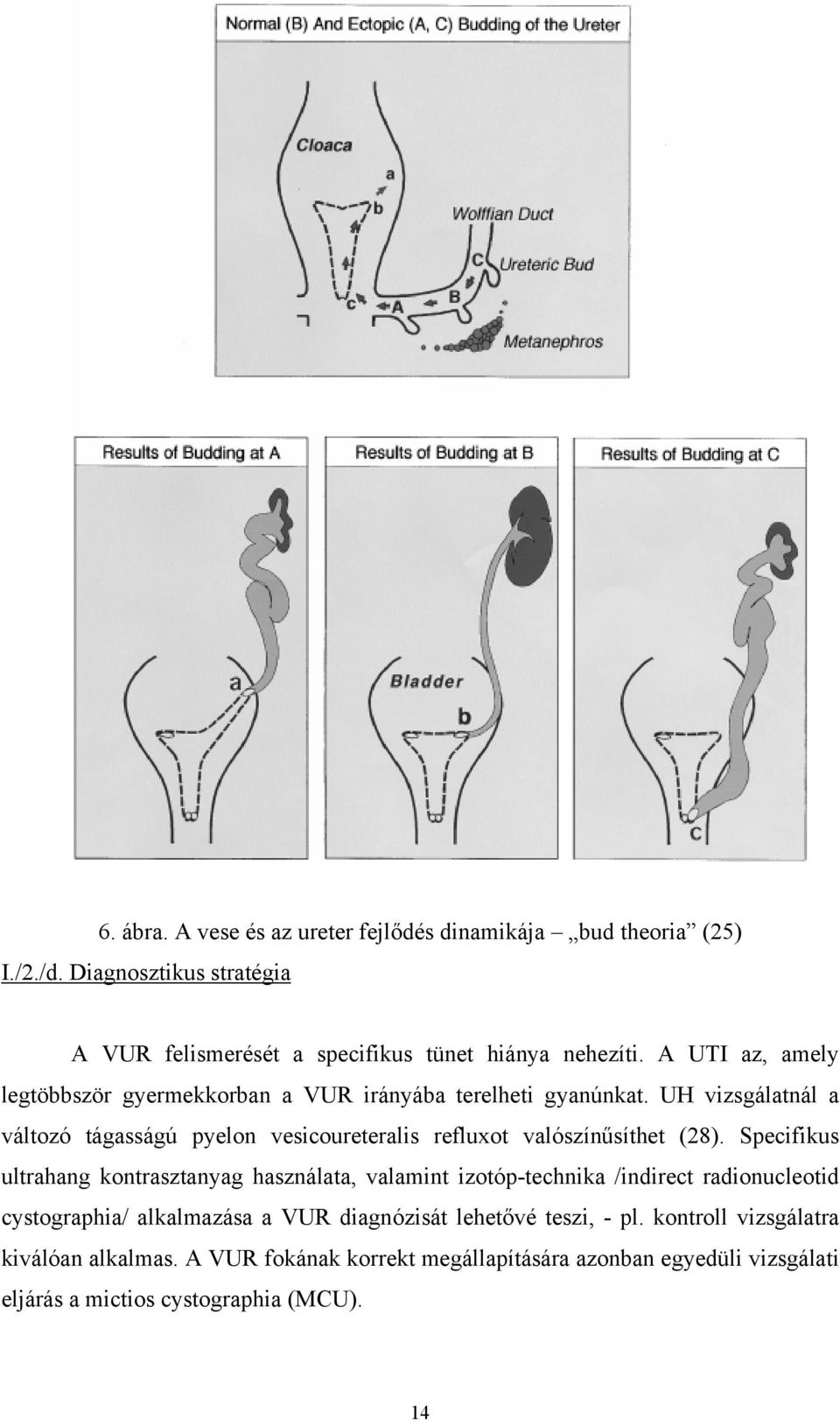 UH vizsgálatnál a változó tágasságú pyelon vesicoureteralis refluxot valószínűsíthet (28).