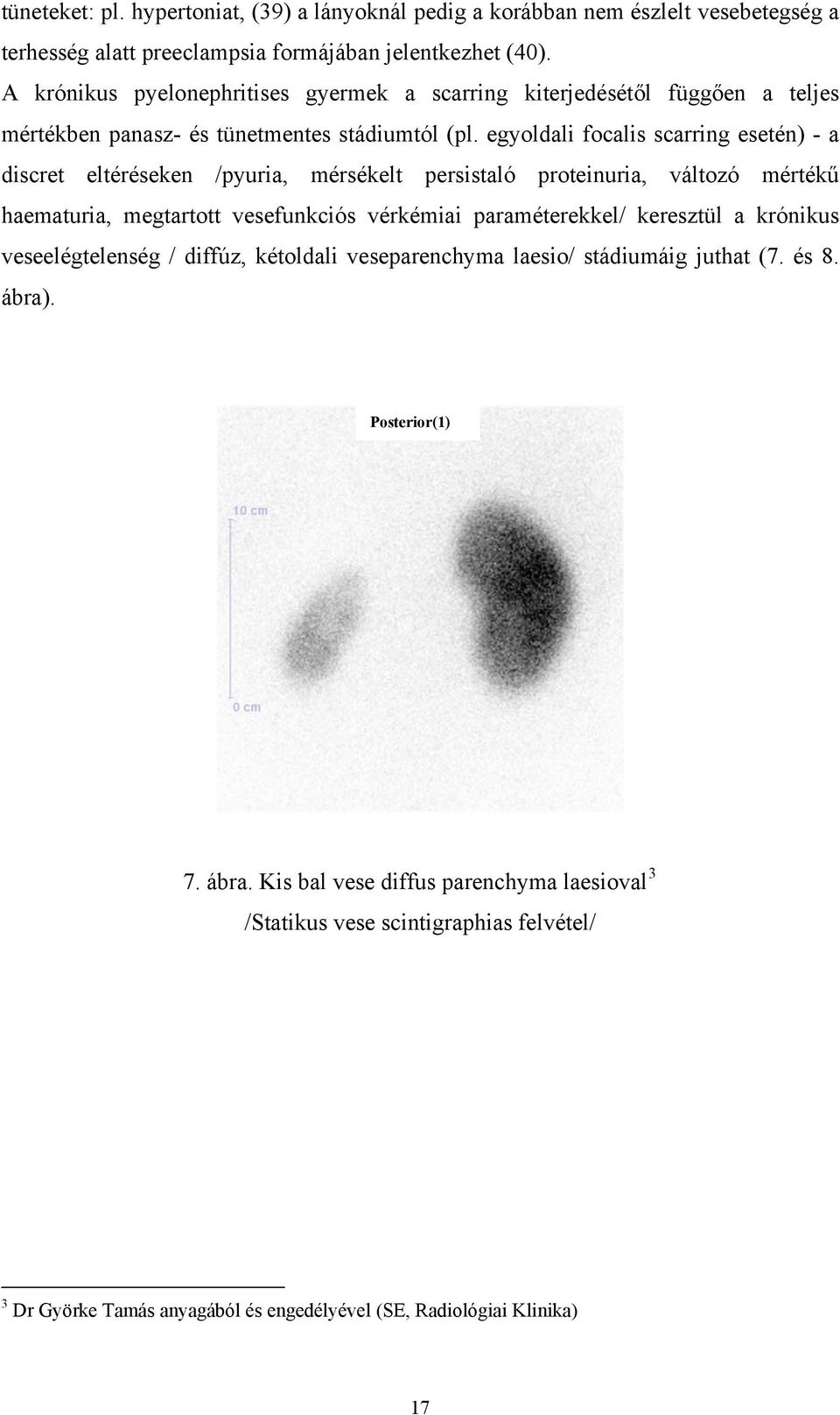 egyoldali focalis scarring esetén) - a discret eltéréseken /pyuria, mérsékelt persistaló proteinuria, változó mértékű haematuria, megtartott vesefunkciós vérkémiai paraméterekkel/