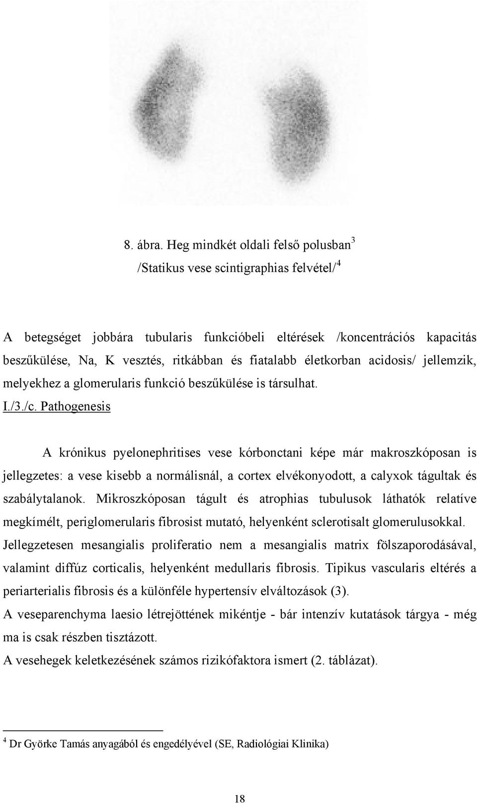 fiatalabb életkorban acidosis/ jellemzik, melyekhez a glomerularis funkció beszűkülése is társulhat. I./3./c.