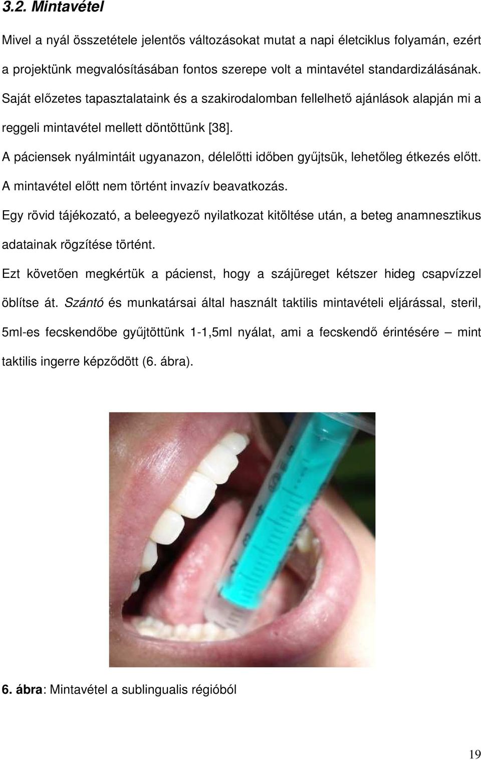 A páciensek nyálmintáit ugyanazon, délelőtti időben gyűjtsük, lehetőleg étkezés előtt. A mintavétel előtt nem történt invazív beavatkozás.