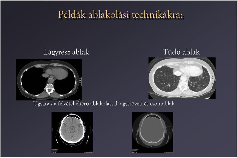 Ugyanaz a felvétel eltérő