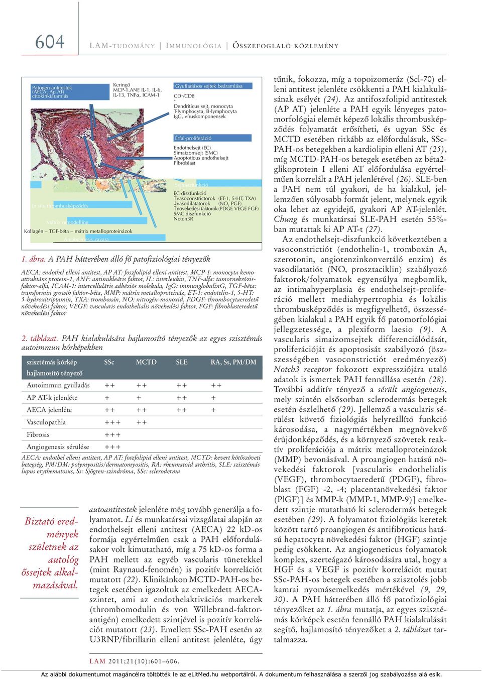 A PAH hátterében álló fô patofiziológiai tényezôk AECA: endothel elleni antitest, AP AT: foszfolipid elleni antitest, MCP-1: monocyta kemoattraktáns protein-1, ANF: antinukleáris faktor, IL: