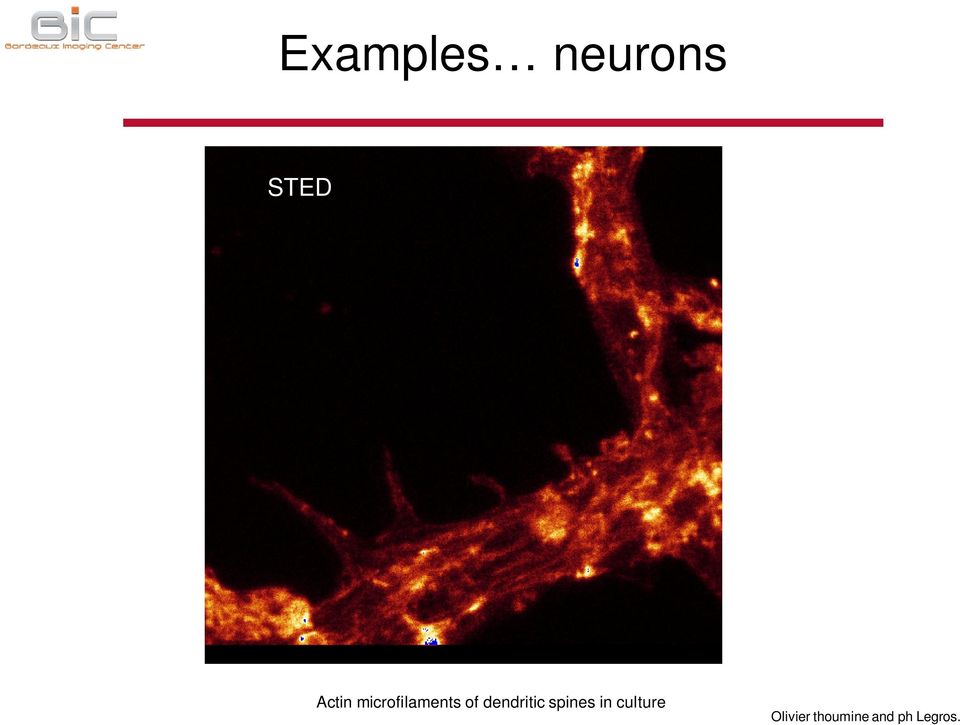 dendritic spines in culture