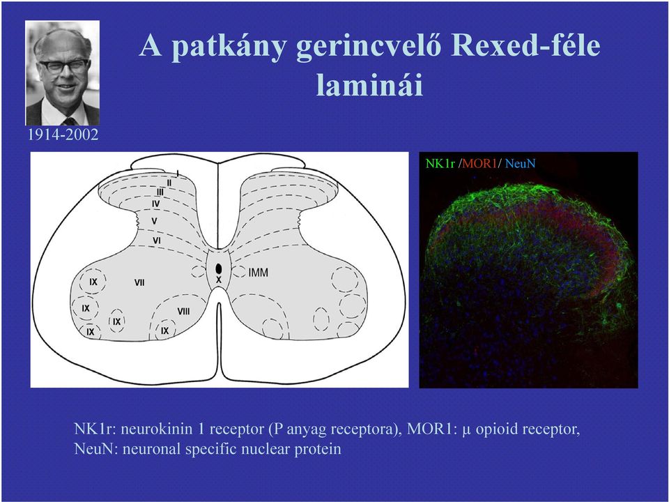 1 receptor (P anyag receptora), MOR1: µ