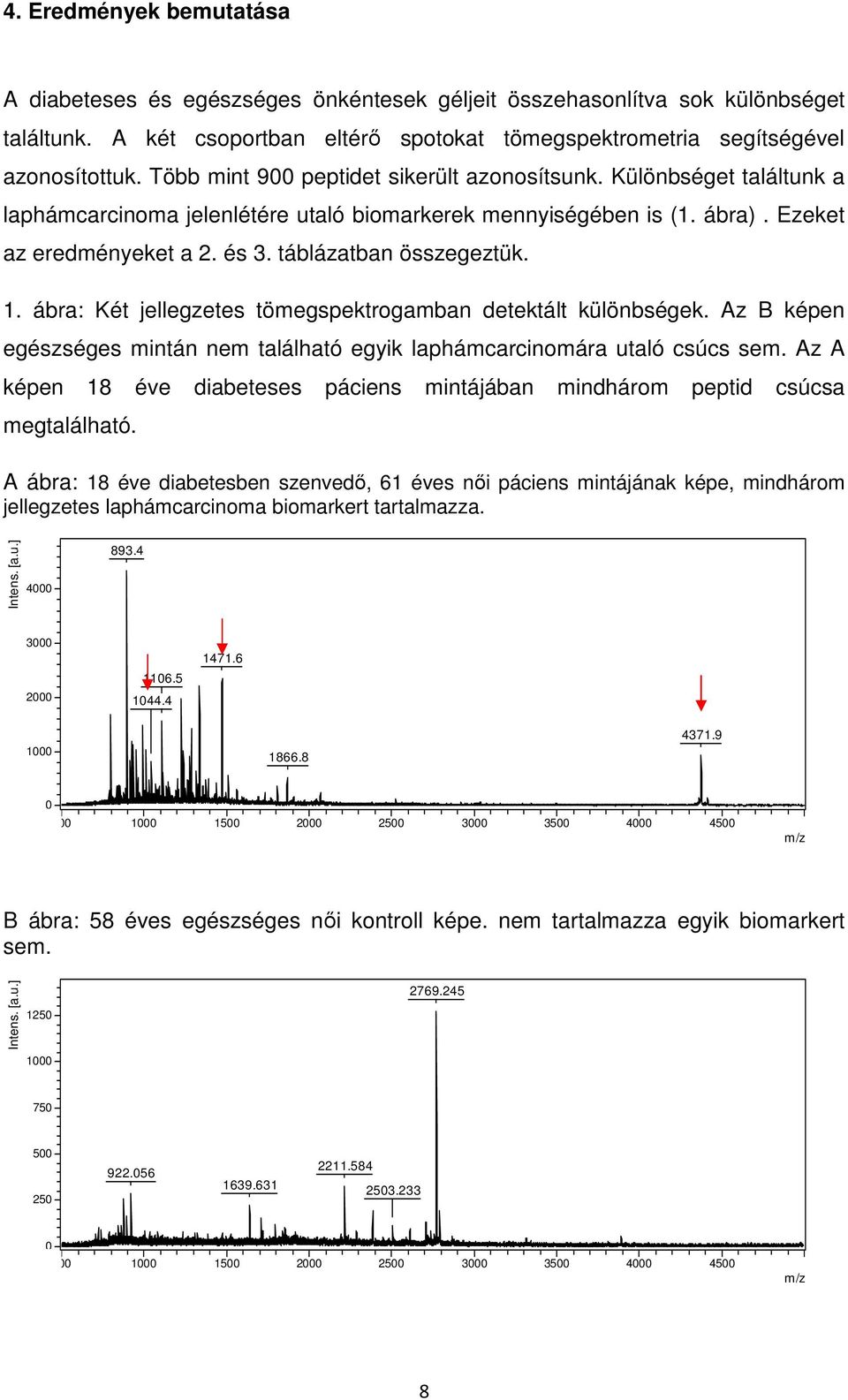 táblázatban összegeztük. 1. ábra: Két jellegzetes tömegspektrogamban detektált különbségek. Az B képen egészséges mintán nem található egyik laphámcarcinomára utaló csúcs sem.