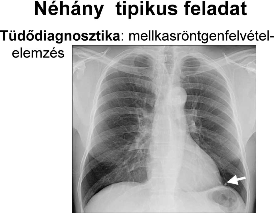 Tüdődiagnosztika: