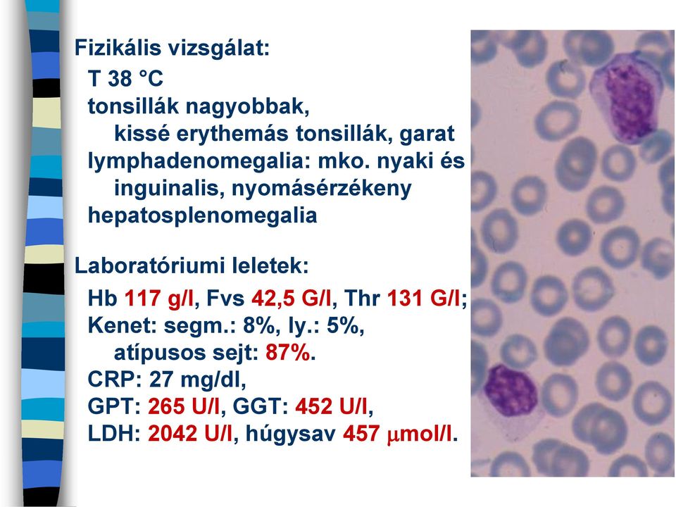 nyaki és inguinalis, nyomásérzékeny hepatosplenomegalia Laboratóriumi leletek: Hb 117