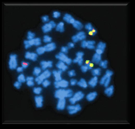 Fluoreszcens in situ hibridizáció Metafázisos kromoszóma