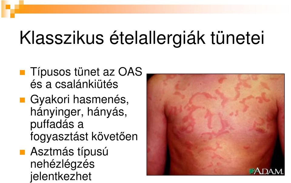 hasmenés, hányinger, hányás, puffadás a