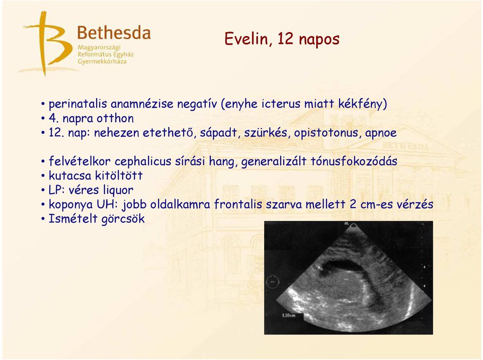 nap: nehezen etethető, sápadt, szürkés, opistotonus, apnoe felvételkor cephalicus