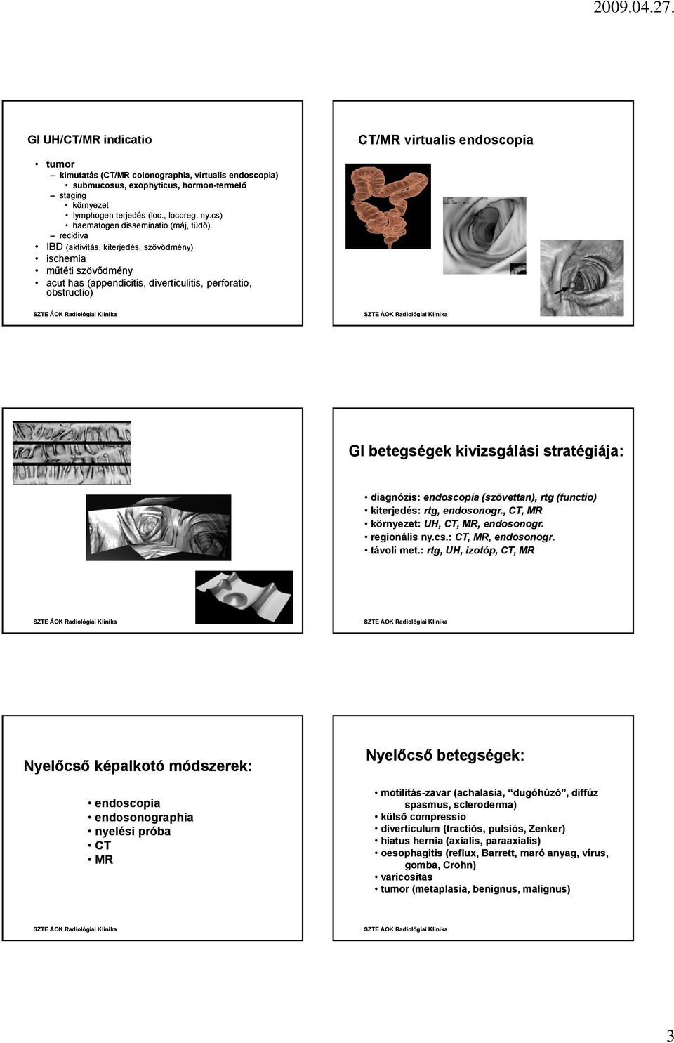 cs) haematogen disseminatio (máj, tüdő) recidiva IBD (aktivitás, kiterjedés, szövődmény) ischemia műtéti szövődmény acut has (appendicitis, diverticulitis, perforatio, obstructio) GI betegségek