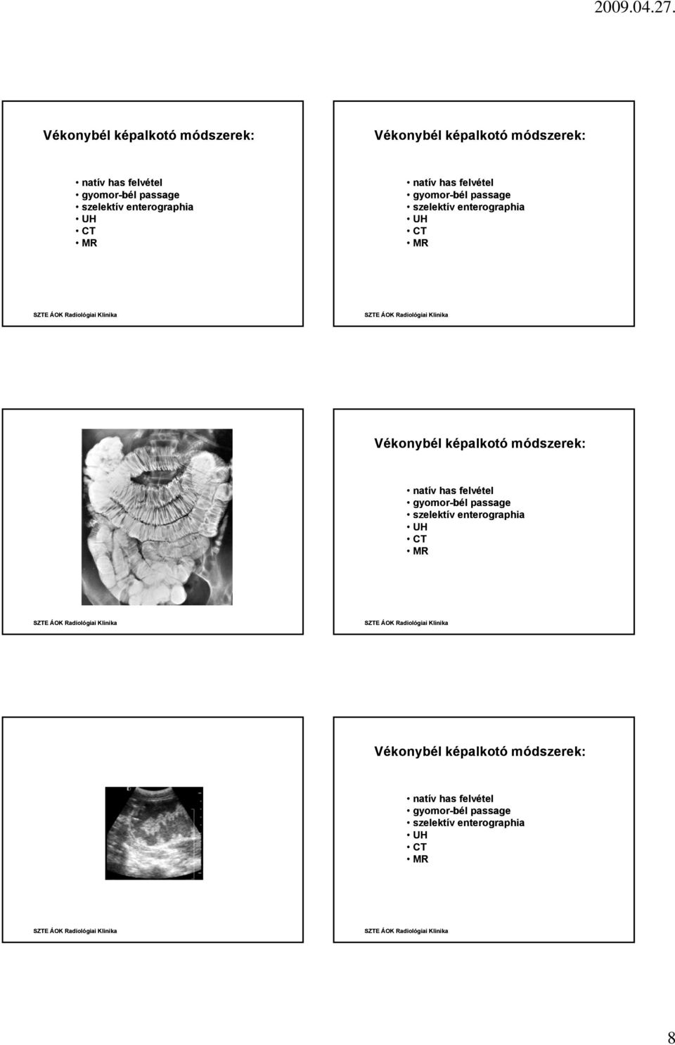 UH Vékonybél képalkotó módszerek: natív has felvétel gyomor-bél passage szelektív enterographia