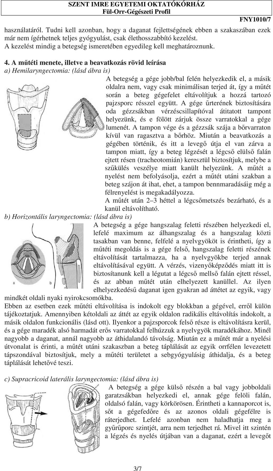 A mőtéti menete, illetve a beavatkozás rövid leírása a) Hemilaryngectomia: (lásd ábra is) A betegség a gége jobb/bal felén helyezkedik el, a másik oldalra nem, vagy csak minimálisan terjed át, így a