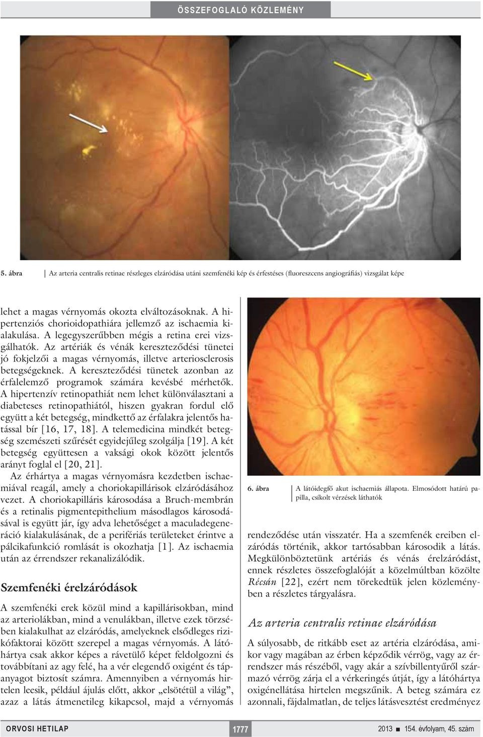 Az artériák és vénák kereszteződési tünetei jó fokjelzői a magas vérnyomás, illetve arteriosclerosis betegségeknek. A kereszteződési tünetek azonban az érfalelemző programok számára kevésbé mérhetők.