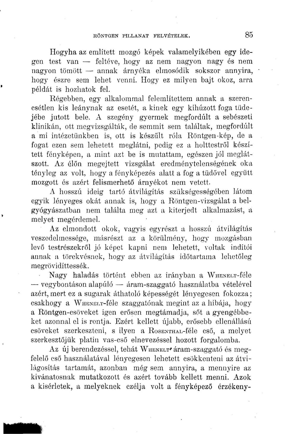 Hogy ez milyen bajt okoz, arra példát is hozhatok fel. Régebben, egy alkalommal felemlítettem annak a szerencsétlen kis leánynak az esetét, a kinek egy kihúzott foga tüdejébe jutott bele.