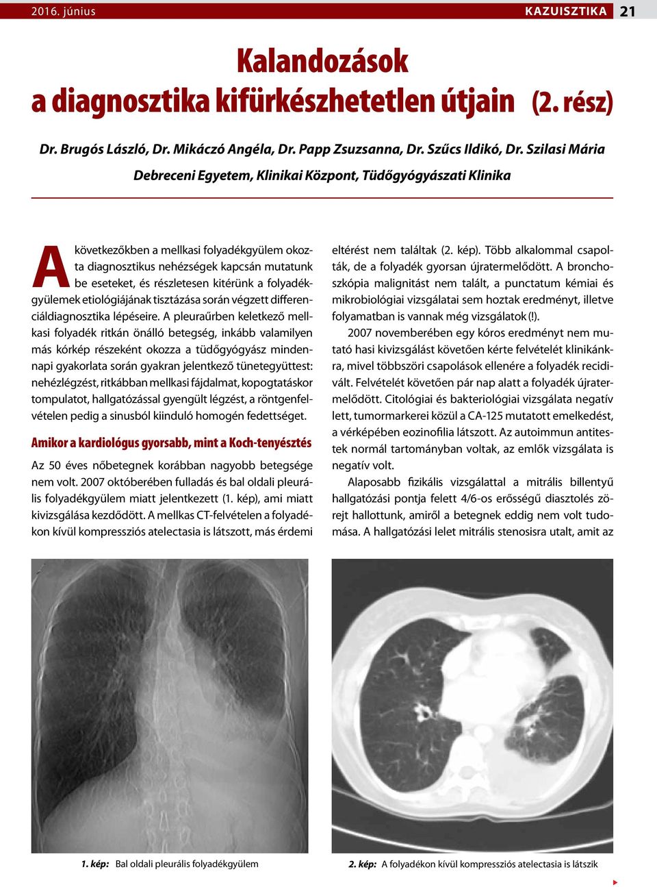 kitérünk a folyadékgyülemek etiológiájának tisztázása során végzett differenciáldiagnosztika lépéseire.