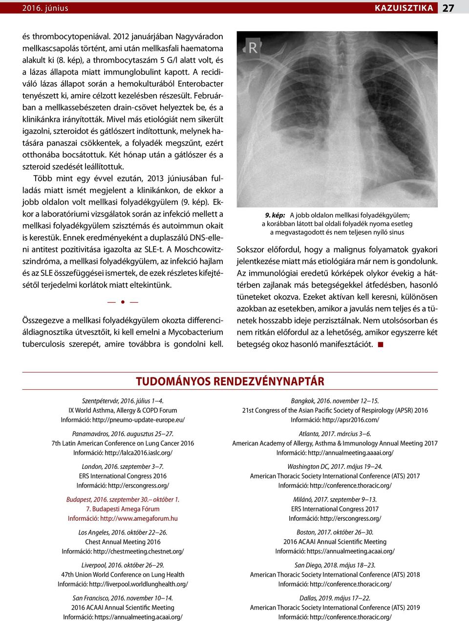 A recidiváló lázas állapot során a hemokulturából Enterobacter tenyészett ki, amire célzott kezelésben részesült.