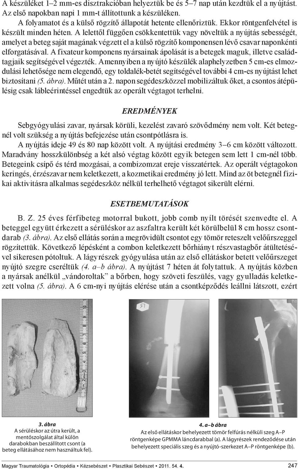 A lelettől függően csökkentettük vagy növeltük a nyújtás sebességét, amelyet a beteg saját magának végzett el a külső rögzítő komponensen lévő csavar naponkénti elforgatásával.