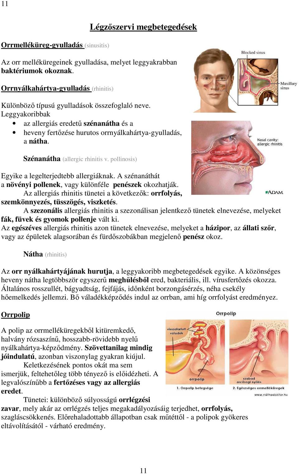 Szénanátha (allergic rhinitis v. pollinosis) Egyike a legelterjedtebb allergiáknak. A szénanáthát a növényi pollenek, vagy különféle penészek okozhatják.