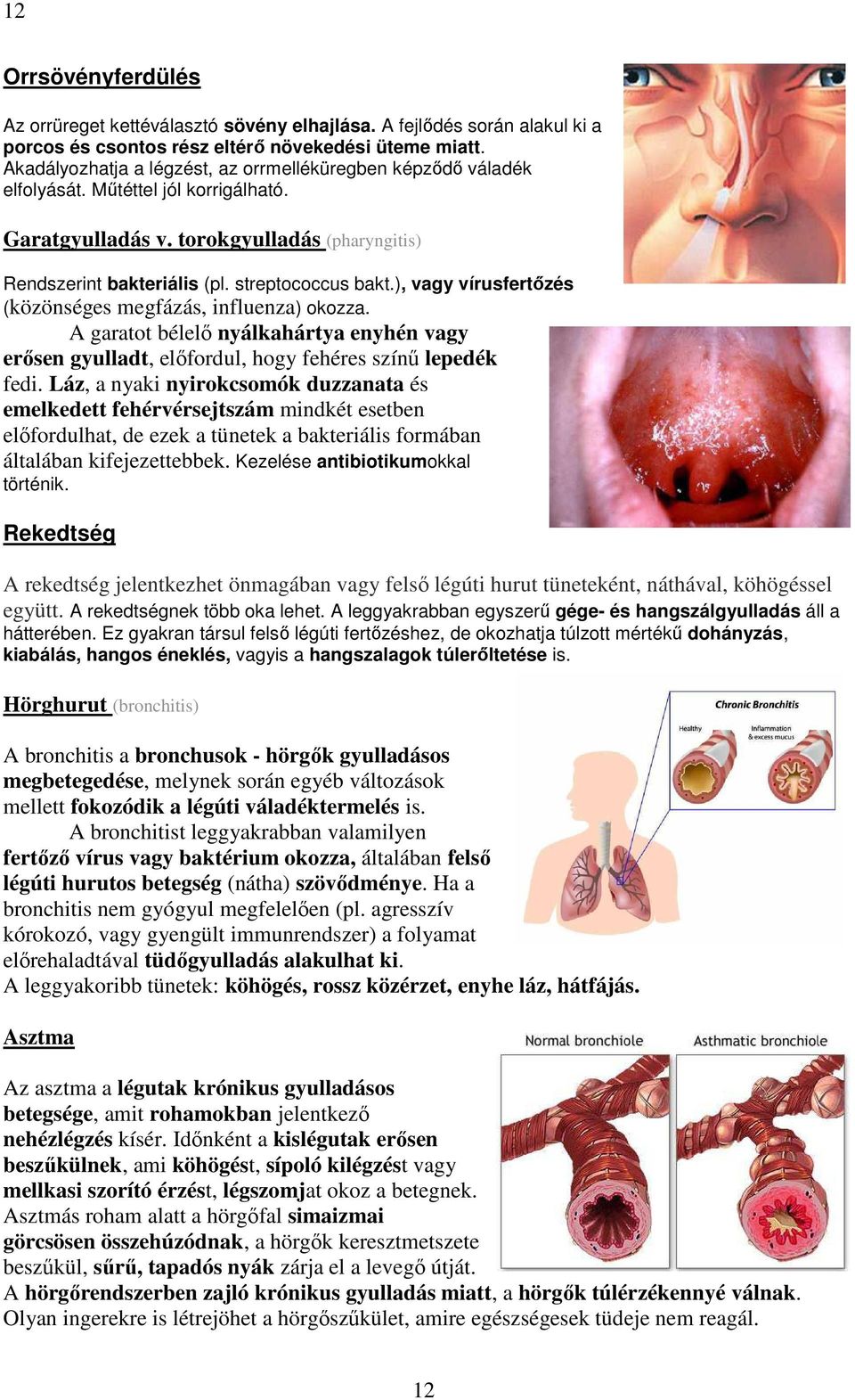 ), vagy vírusfertőzés (közönséges megfázás, influenza) okozza. A garatot bélelő nyálkahártya enyhén vagy erősen gyulladt, előfordul, hogy fehéres színű lepedék fedi.