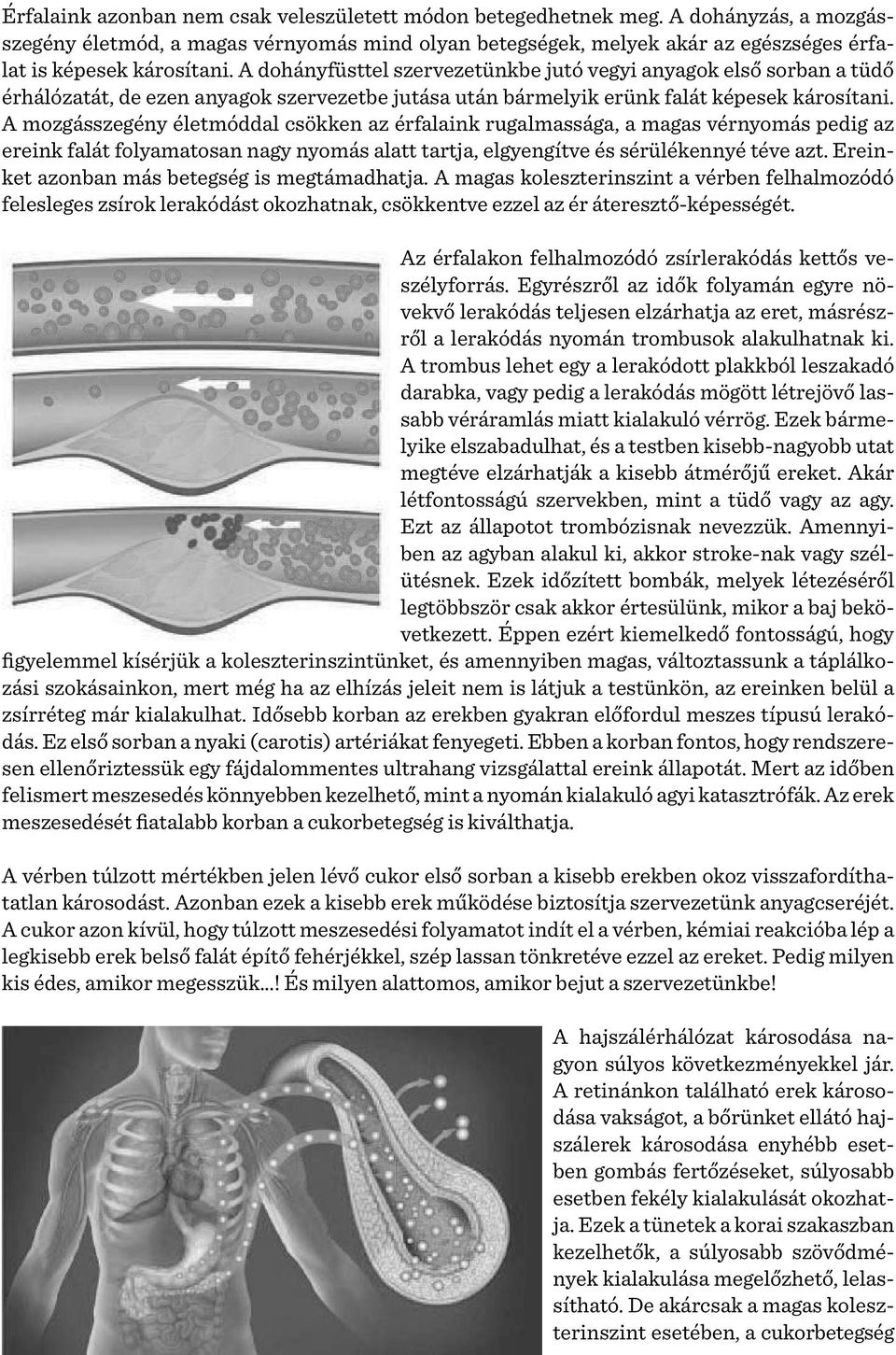 A dohányfüsttel szervezetünkbe jutó vegyi anyagok első sorban a tüdő érhálózatát, de ezen anyagok szervezetbe jutása után bármelyik erünk falát képesek károsítani.