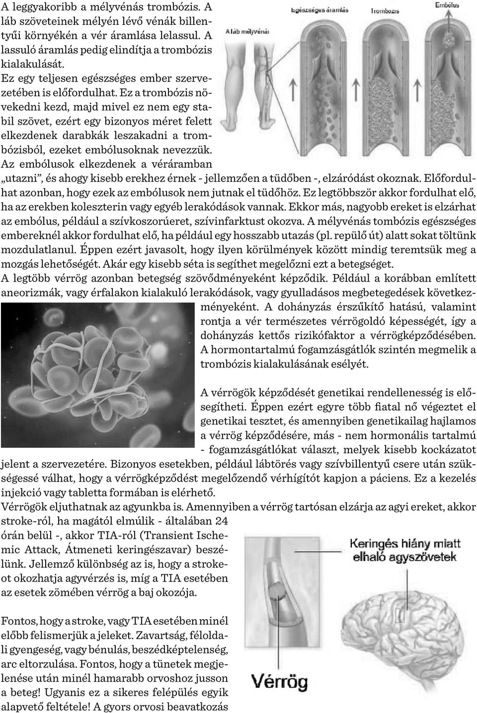 Ez a trombózis növekedni kezd, majd mivel ez nem egy stabil szövet, ezért egy bizonyos méret felett elkezdenek darabkák leszakadni a trombózisból, ezeket embólusoknak nevezzük.