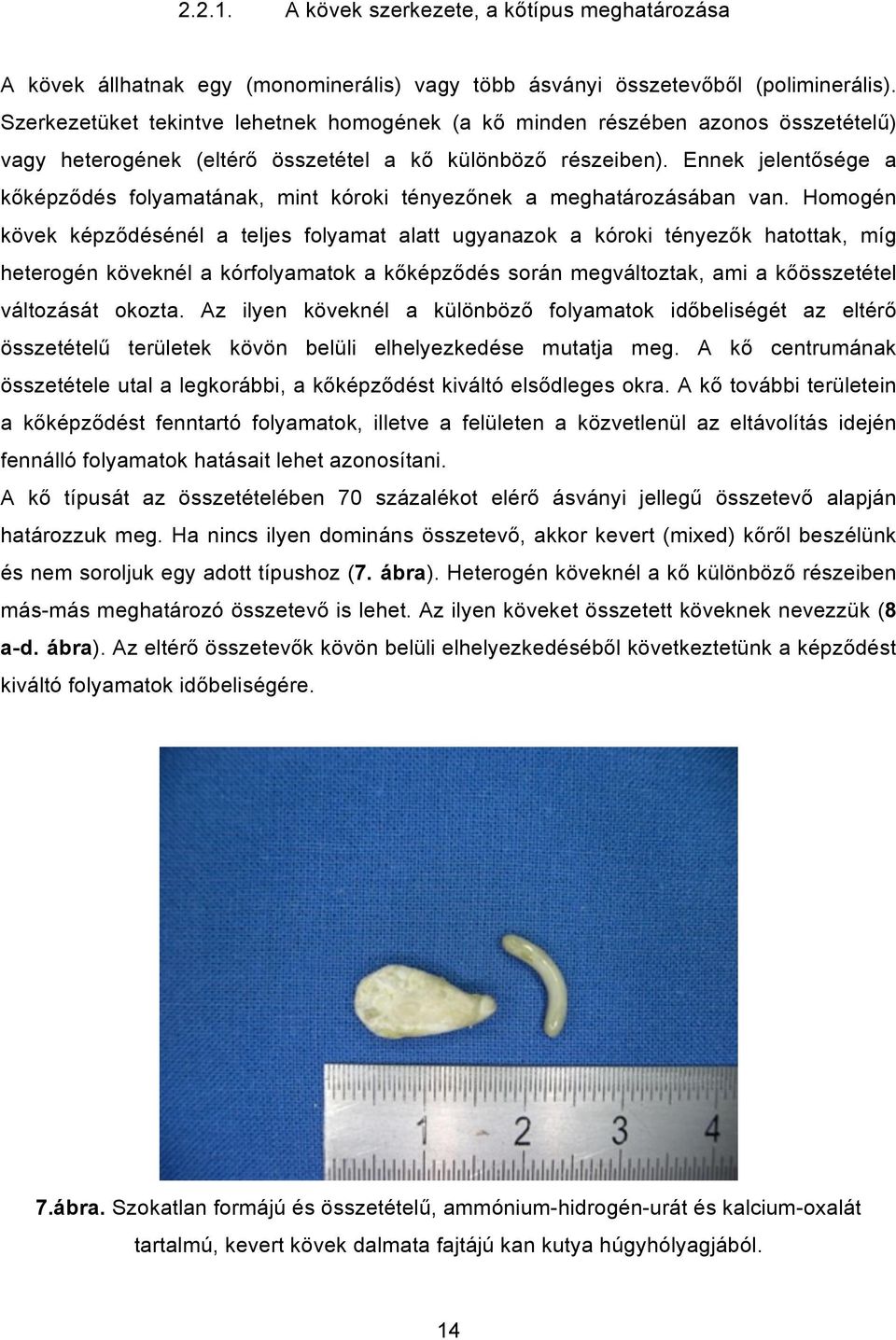 Ennek jelentősége a kőképződés folyamatának, mint kóroki tényezőnek a meghatározásában van.