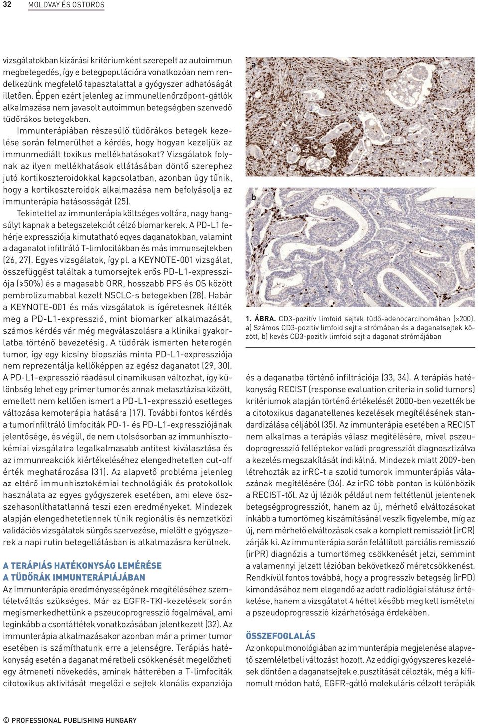 Immunterápiában részesülő tüdőrákos betegek kezelése során felmerülhet a kérdés, hogy hogyan kezeljük az immunmediált toxikus mellékhatásokat?