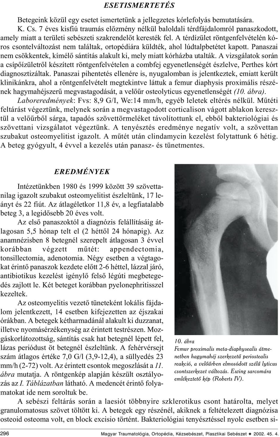 A térdízület röntgenfelvételén kóros csontelváltozást nem találtak, ortopédiára küldték, ahol lúdtalpbetétet kapott. Panaszai nem csökkentek, kímélõ sántítás alakult ki, mely miatt kórházba utalták.