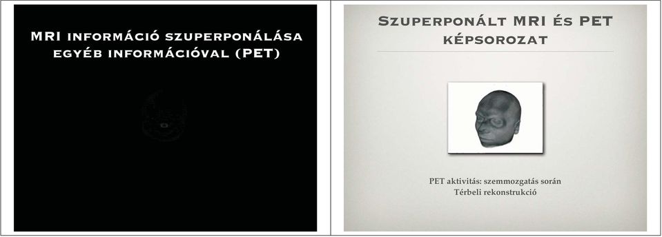 és PET képsorozat PET aktivitás: