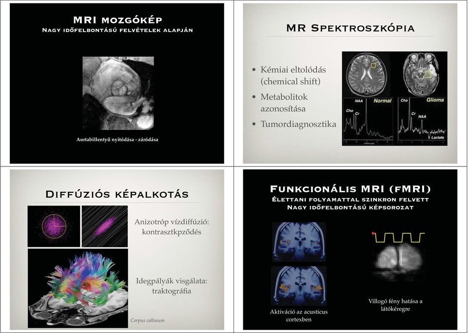 vízdiffúzió: kontrasztkpződés Funkcionális MRI (fmri) Élettani folyamattal szinkron felvett Nagy időfelbontású