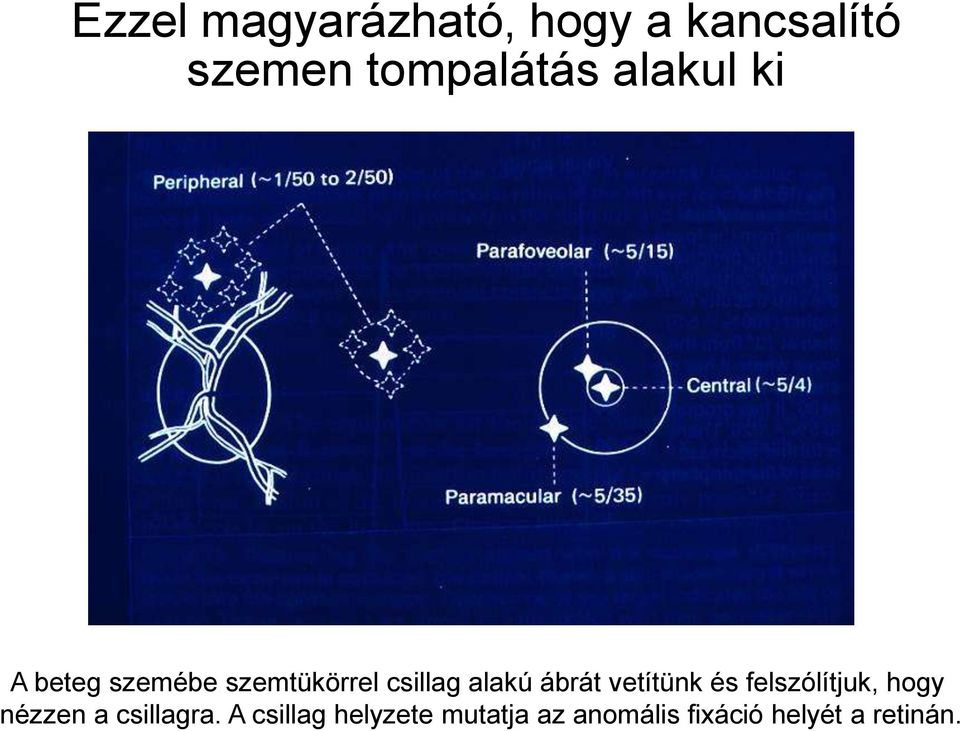 ábrát vetítünk és felszólítjuk, hogy nézzen a csillagra.