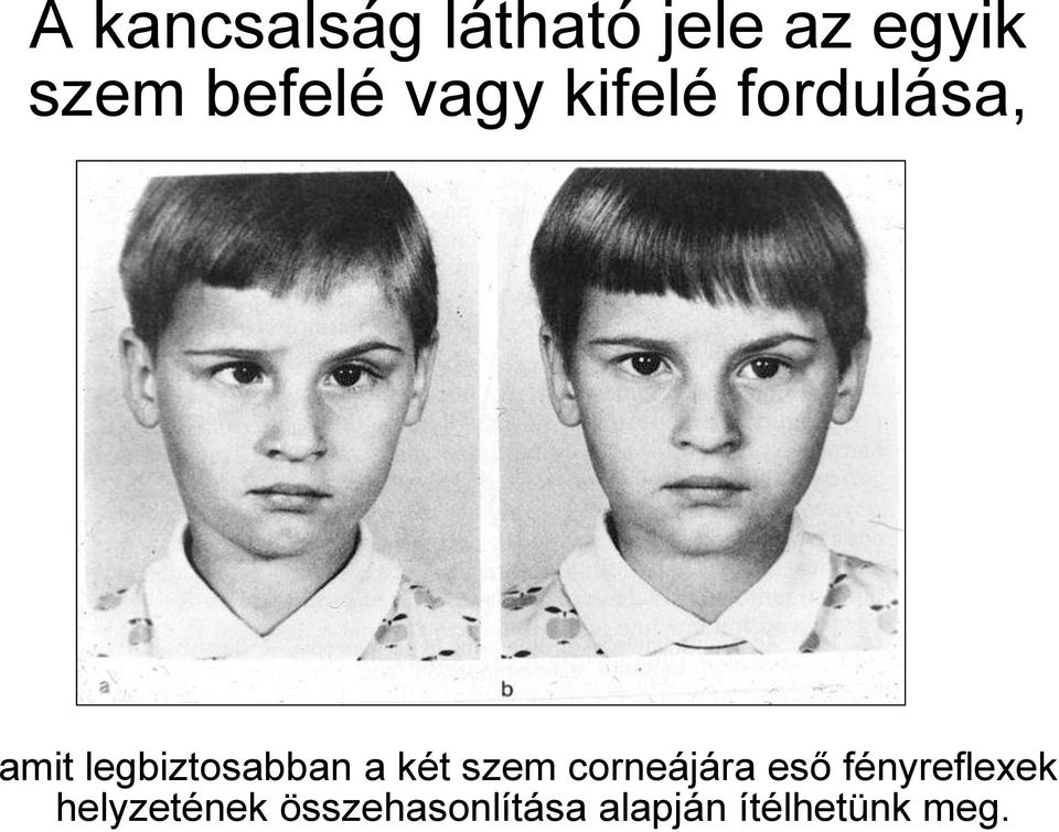 legbiztosabban a két szem corneájára eső