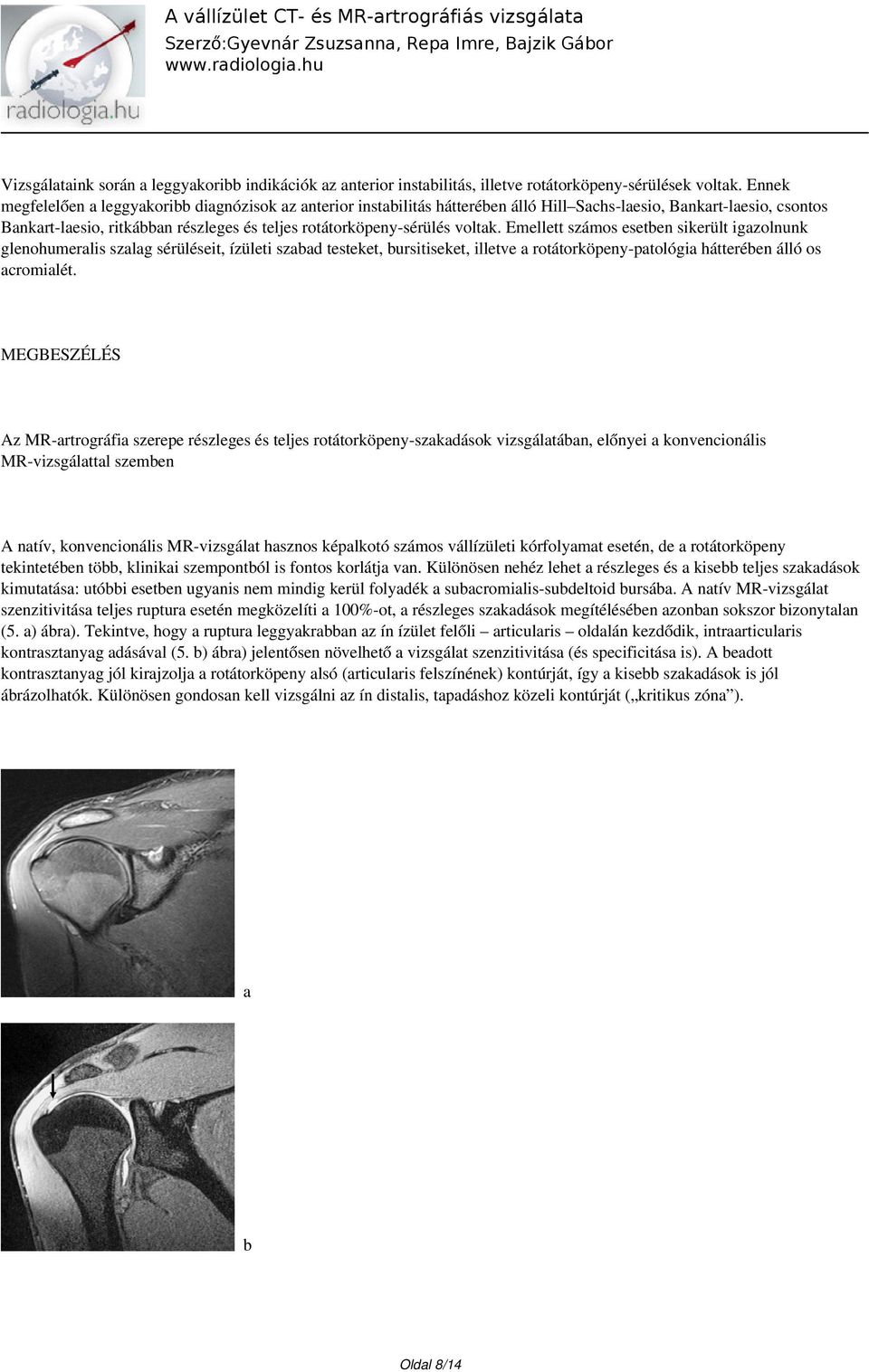 voltak. Emellett számos esetben sikerült igazolnunk glenohumeralis szalag sérüléseit, ízületi szabad testeket, bursitiseket, illetve a rotátorköpeny-patológia hátterében álló os acromialét.