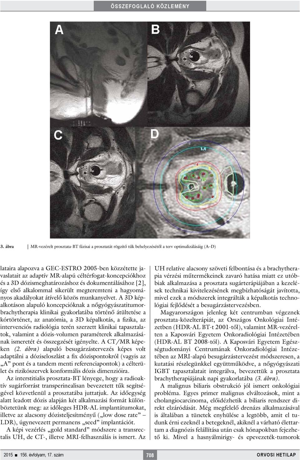 A 3D képalkotáson alapuló koncepcióknak a nőgyógyászatitumorbrachytherapia klinikai gyakorlatába történő átültetése a kórtörténet, az anatómia, a 3D képalkotás, a fizika, az intervenciós radiológia